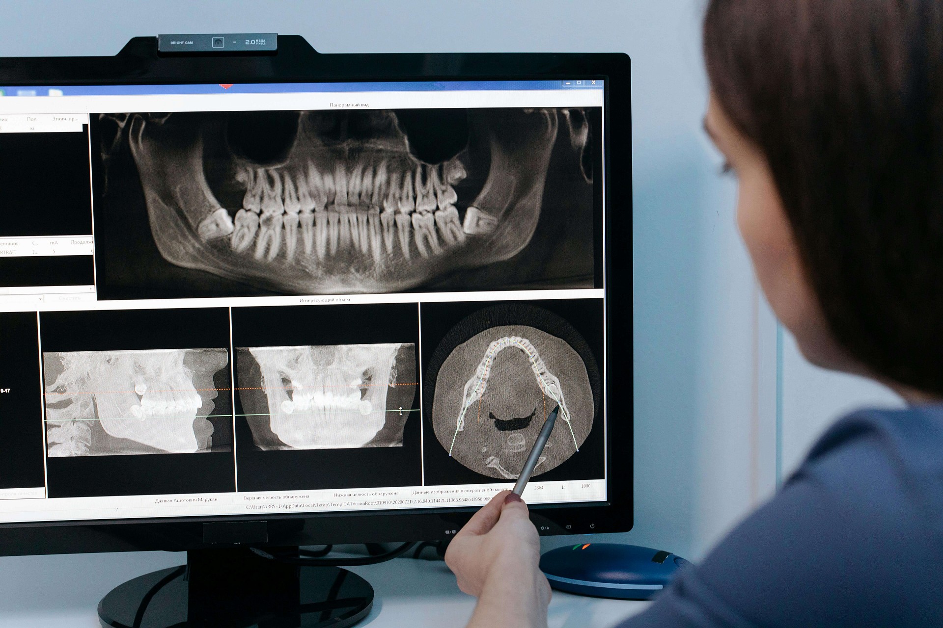 Röntgenfelvétel a fogorvosnál? Biztonságosabb, mint gondolná